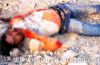 Accident on old Netravathi Bridge: Young bike rider loses life